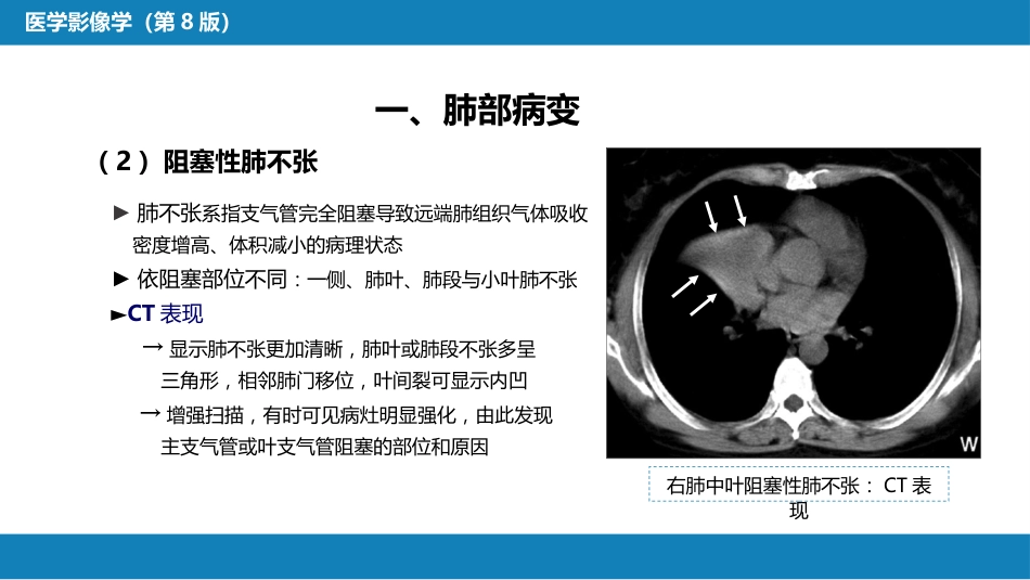 第四章 呼吸系统 第三节 基本病变表现_第8页