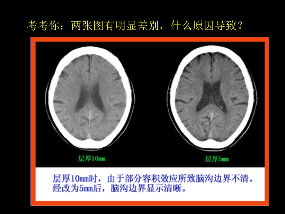 影像报告书写_第5页