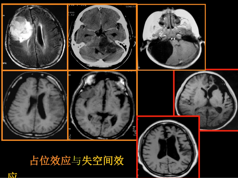 影像报告书写_第8页