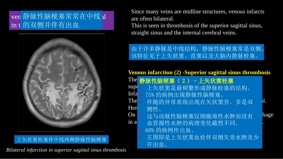 脑静脉血栓形成影像学_第14页