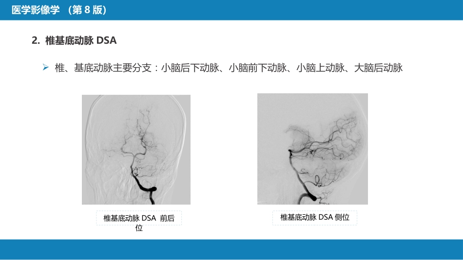 第二章 中枢神经系统 第二节 正常影像表现_第6页
