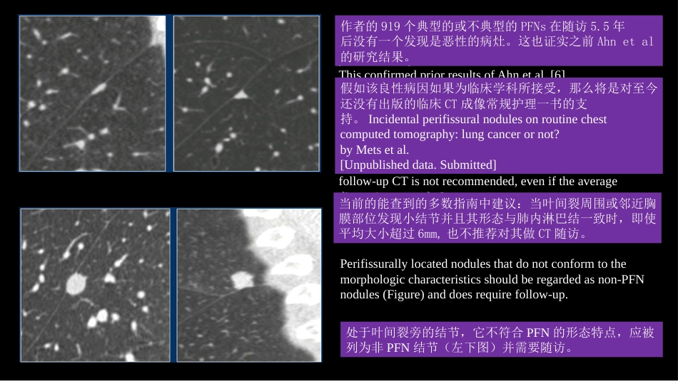 肺结节指南与临床实践_第14页
