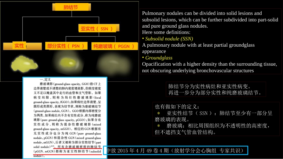 肺结节指南与临床实践_第5页