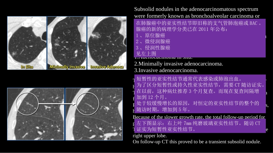 肺结节指南与临床实践_第9页