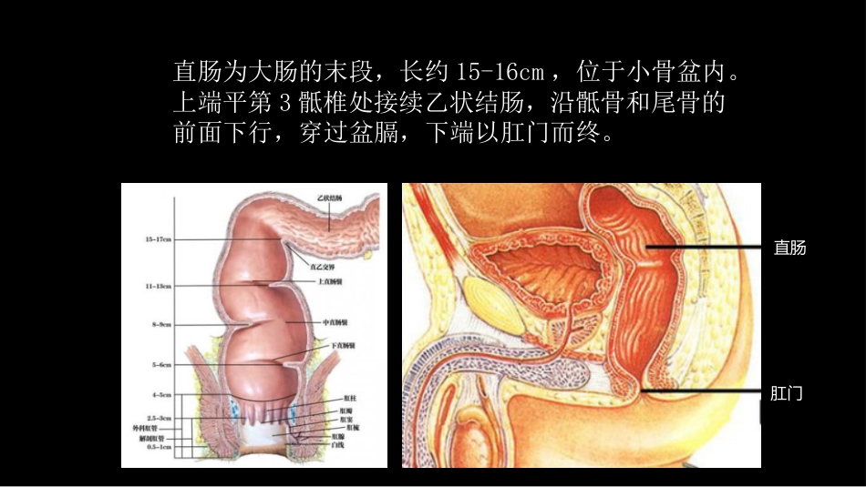 直肠癌：MRI与临床_第2页