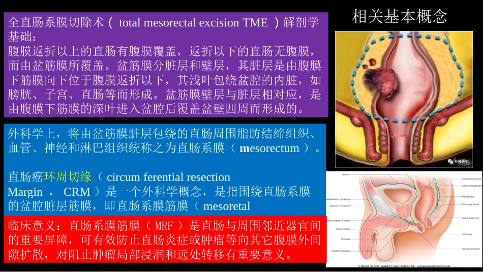直肠癌：MRI与临床_第3页