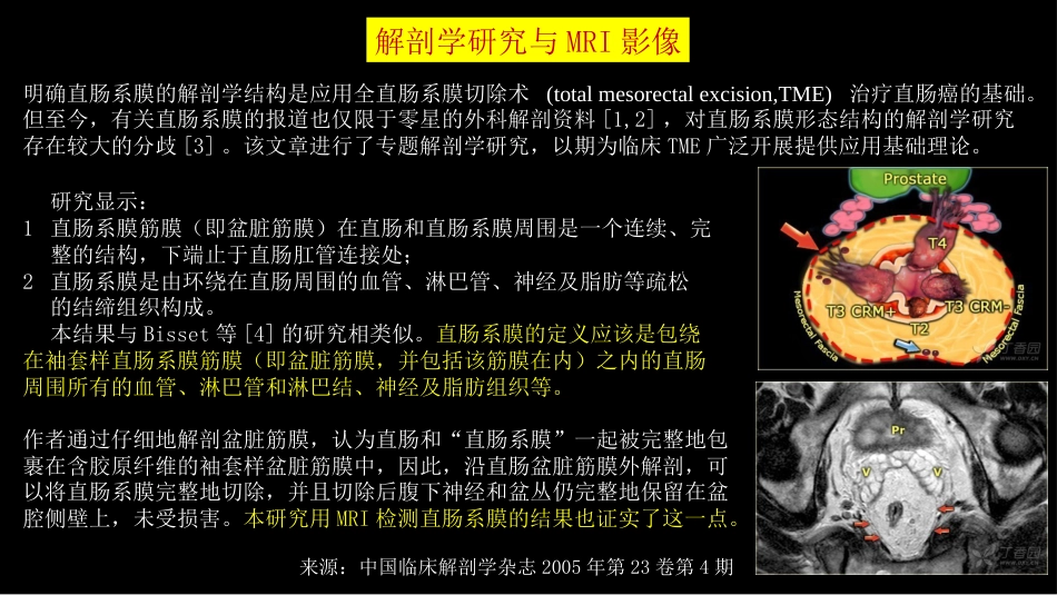 直肠癌：MRI与临床_第4页