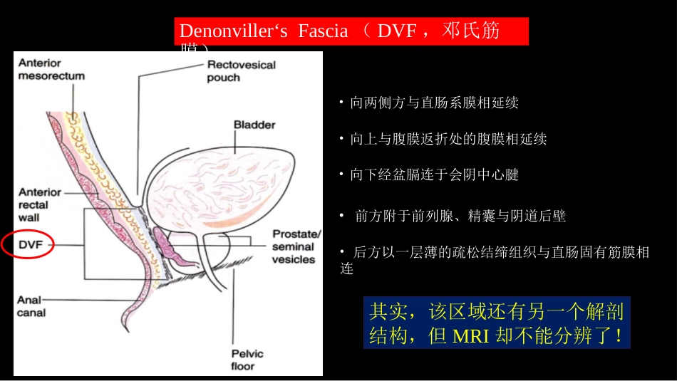 直肠癌：MRI与临床_第6页