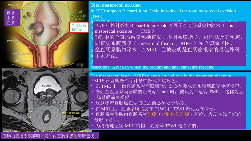 直肠癌：MRI与临床_第9页
