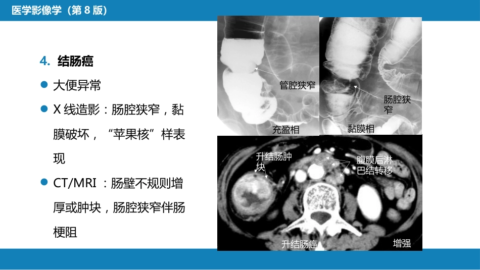 第七章 消化系统与腹膜腔 第一节 食管与胃肠道_第12页