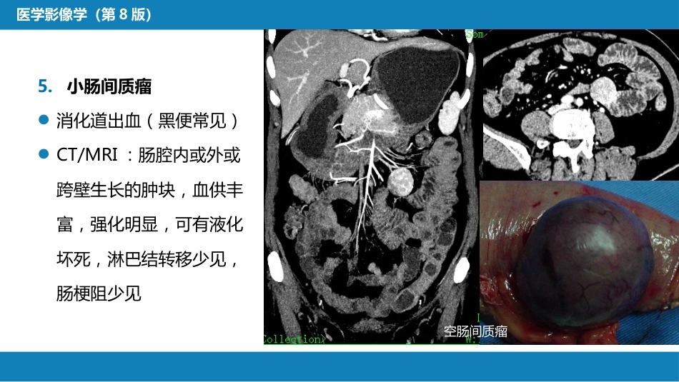第七章 消化系统与腹膜腔 第一节 食管与胃肠道_第13页