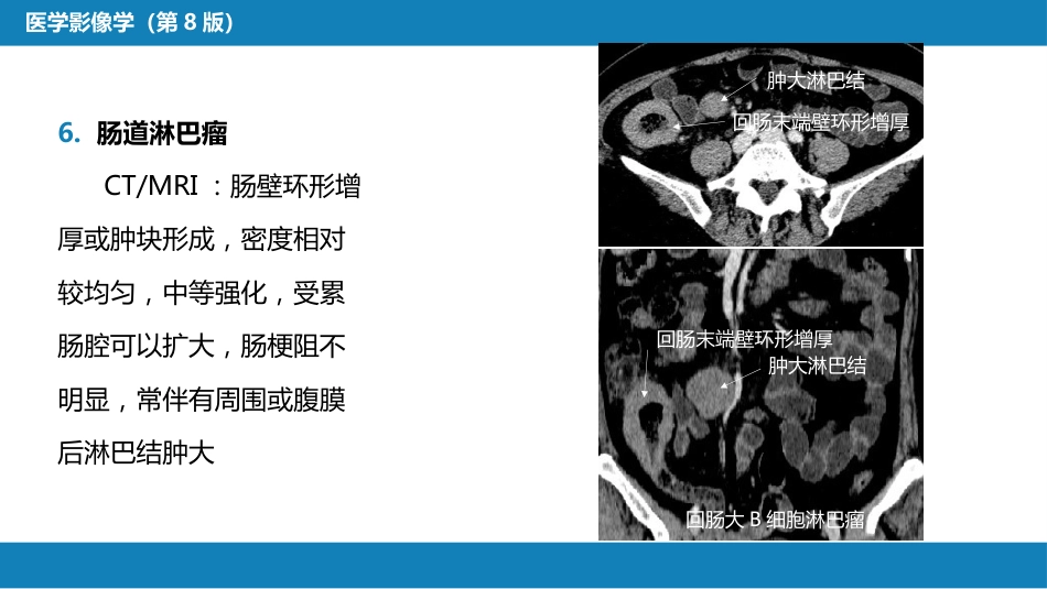 第七章 消化系统与腹膜腔 第一节 食管与胃肠道_第14页