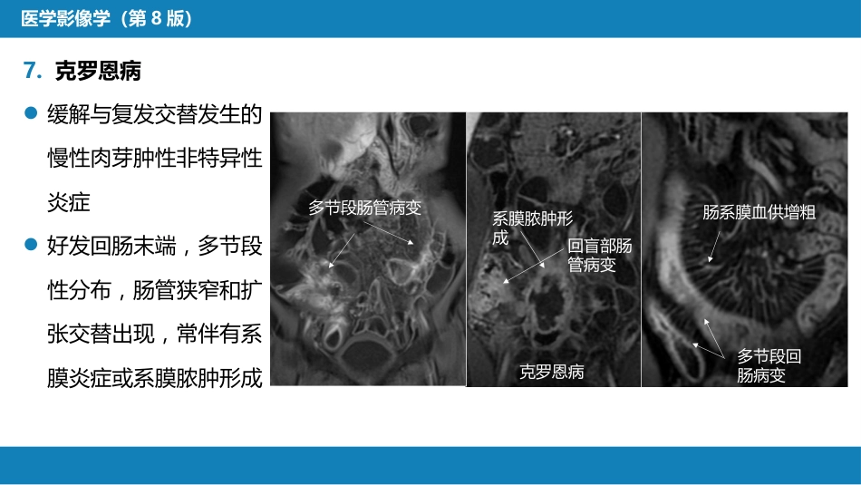 第七章 消化系统与腹膜腔 第一节 食管与胃肠道_第15页