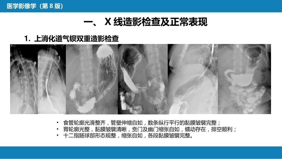 第七章 消化系统与腹膜腔 第一节 食管与胃肠道_第5页