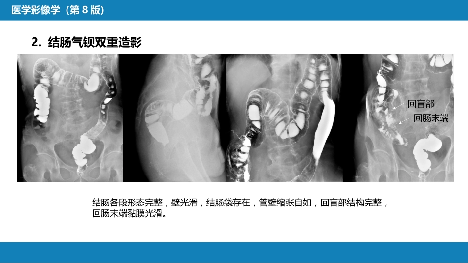 第七章 消化系统与腹膜腔 第一节 食管与胃肠道_第6页