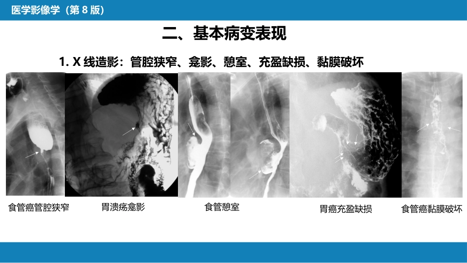 第七章 消化系统与腹膜腔 第一节 食管与胃肠道_第7页