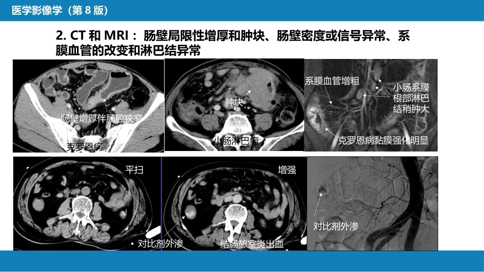 第七章 消化系统与腹膜腔 第一节 食管与胃肠道_第8页