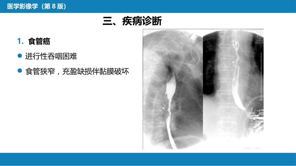 第七章 消化系统与腹膜腔 第一节 食管与胃肠道_第9页