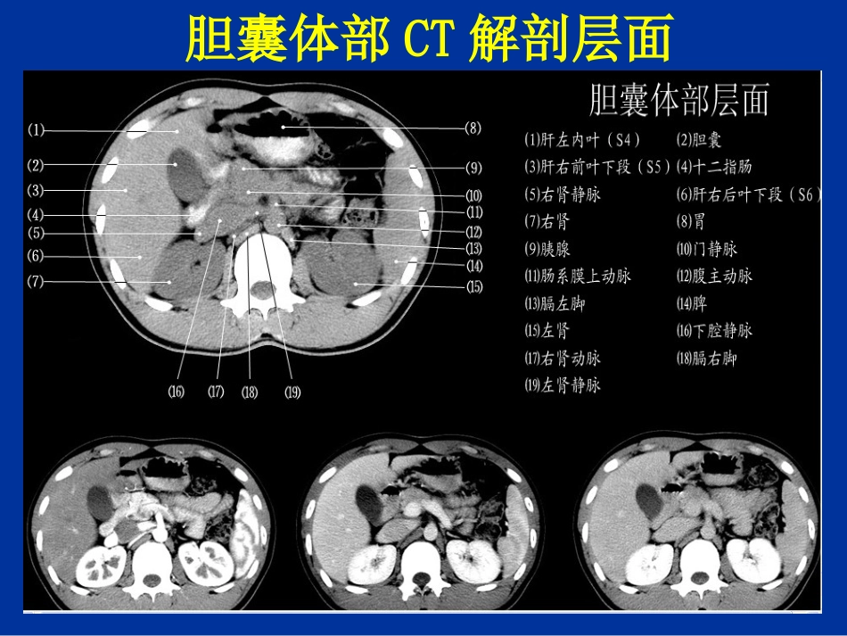 胆道疾病的影像学诊断_第8页
