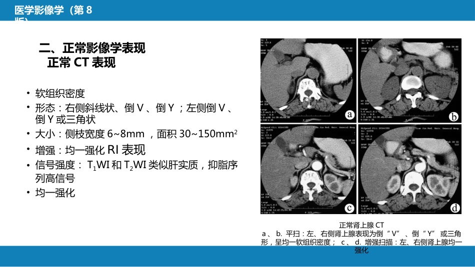 第八章 泌尿生殖系统与腹膜后间隙 第二节 肾上腺_第6页
