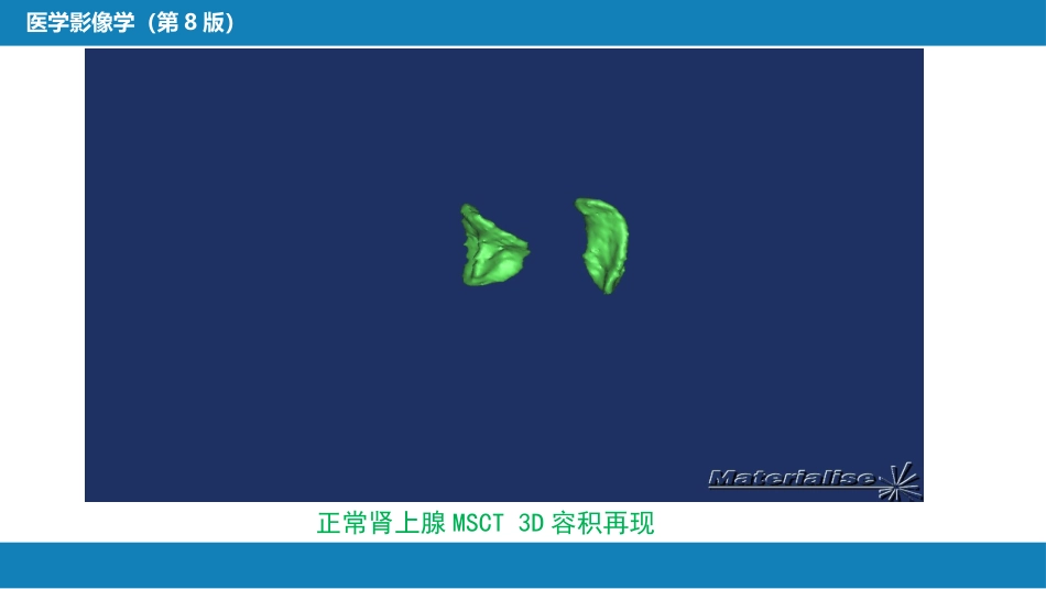 第八章 泌尿生殖系统与腹膜后间隙 第二节 肾上腺_第7页