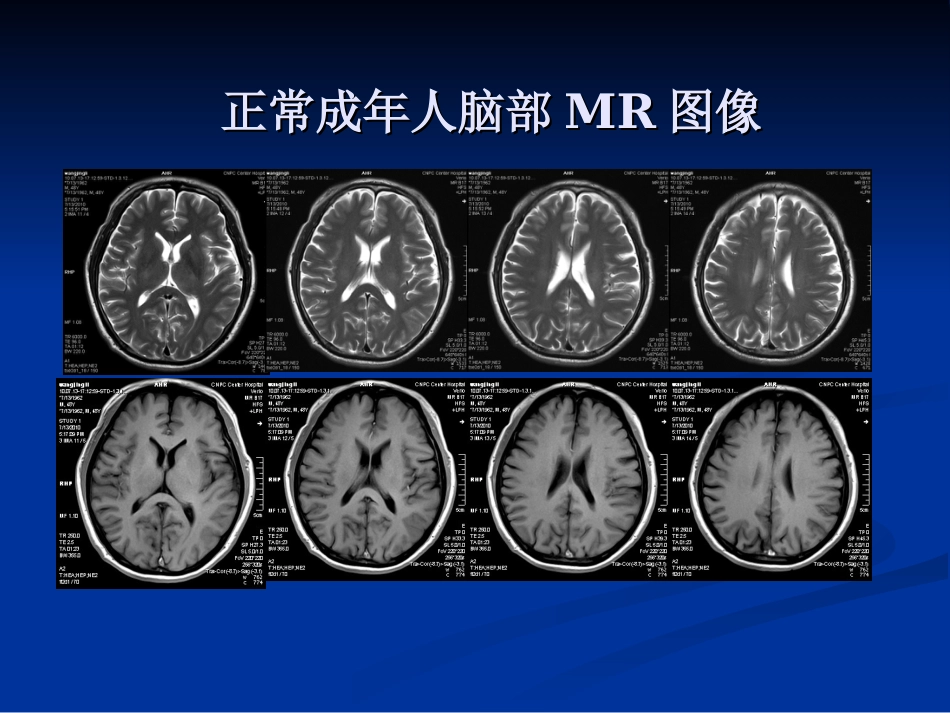 新生儿缺氧缺血性_第4页