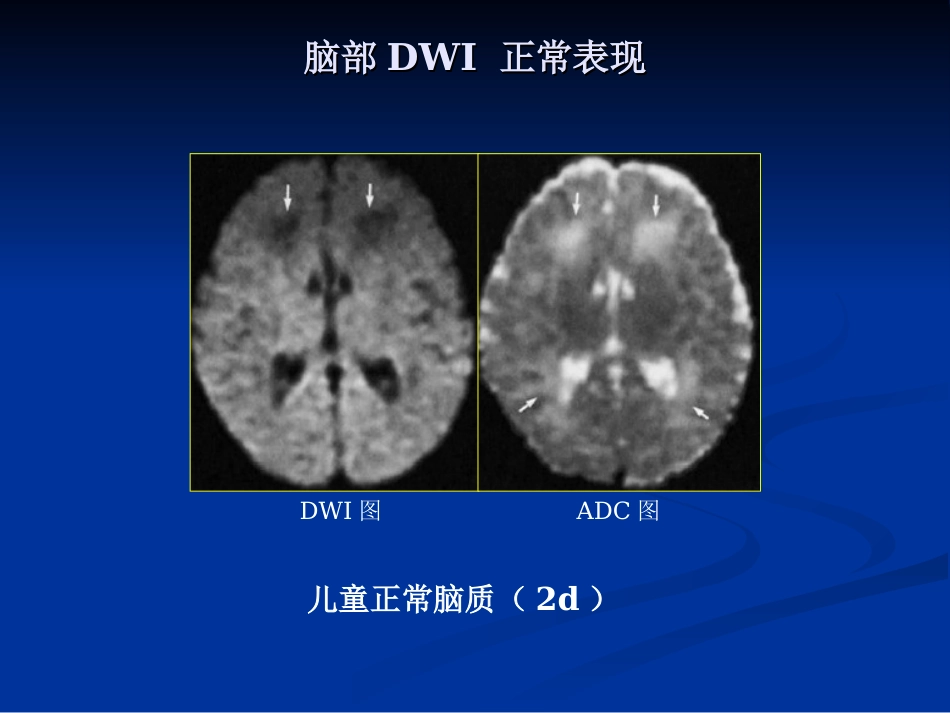 新生儿缺氧缺血性_第9页