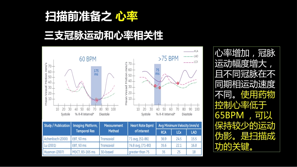 多层螺旋CT冠状动脉疾病诊断再学习之二_第10页