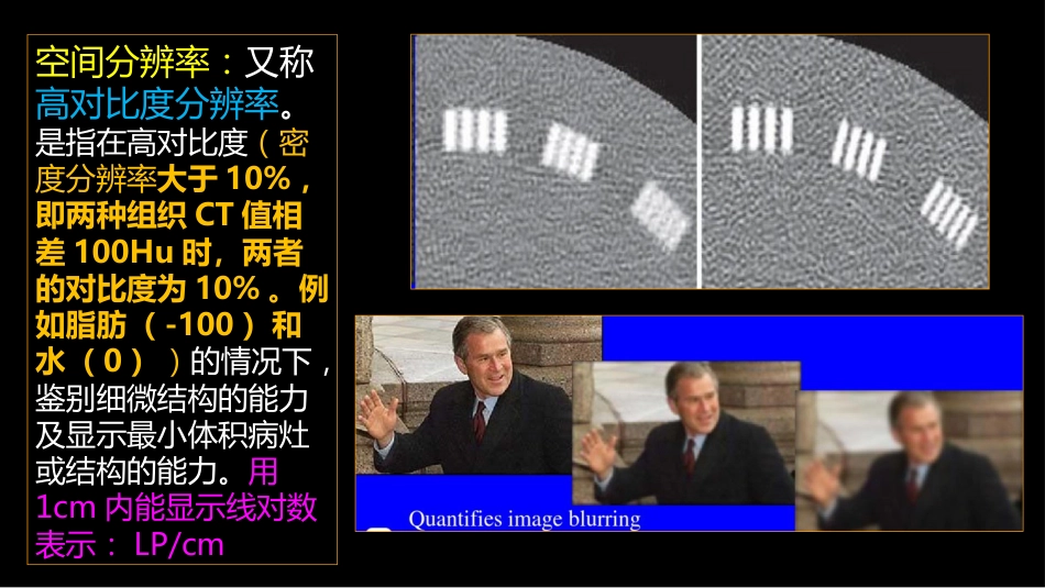 多层螺旋CT冠状动脉疾病诊断再学习之二_第13页