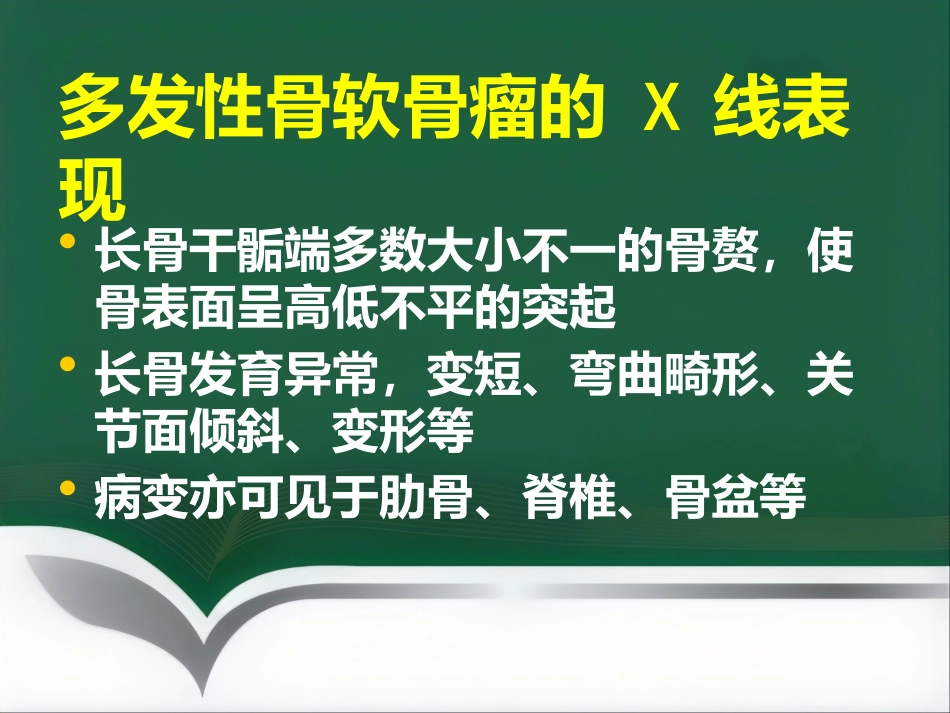 成软骨性骨肿瘤的影像学诊断_第14页