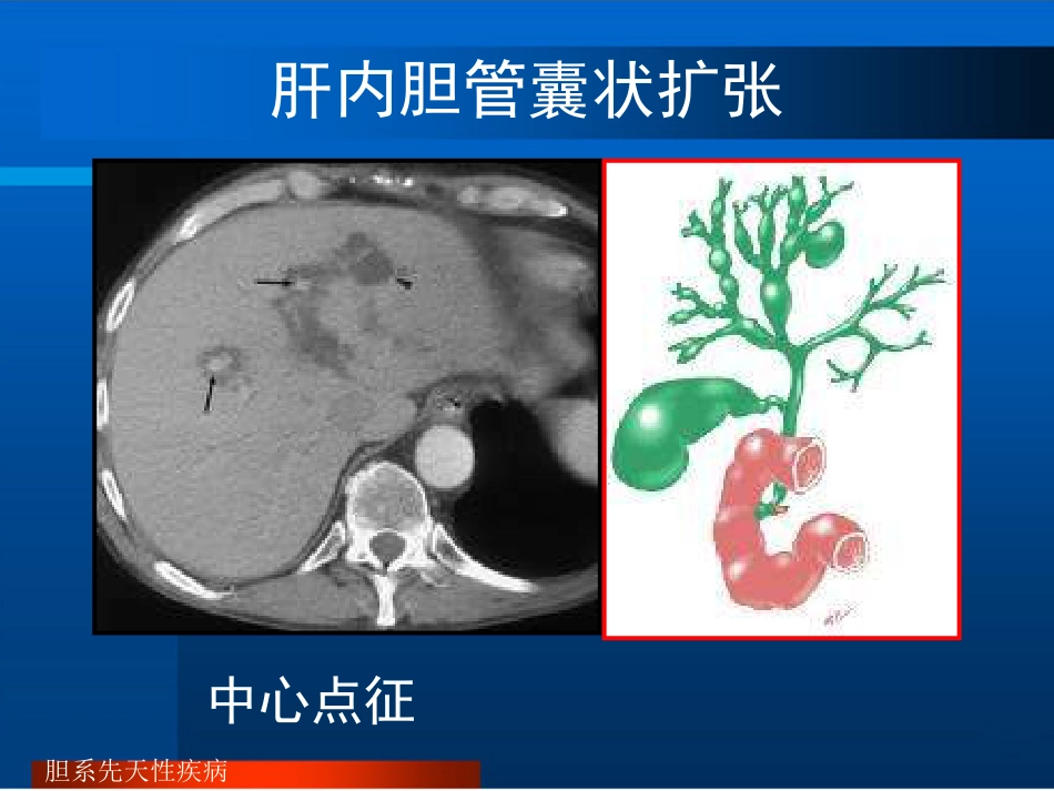 胆道疾病的影像诊断PPT_第12页