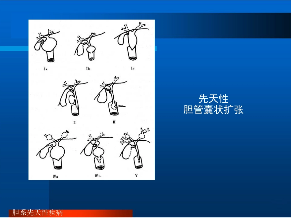 胆道疾病的影像诊断PPT_第5页