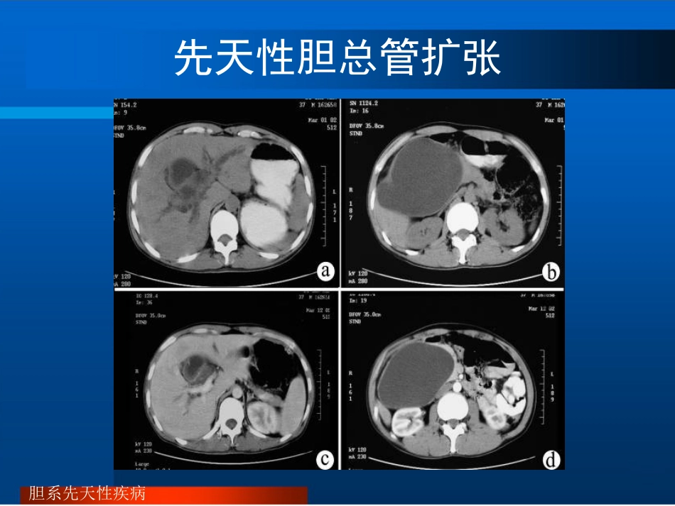 胆道疾病的影像诊断PPT_第8页