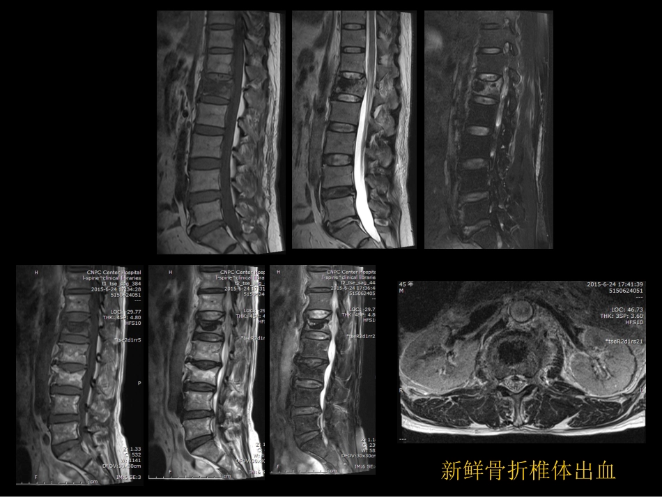 骨与关节常见病影像诊断_第10页