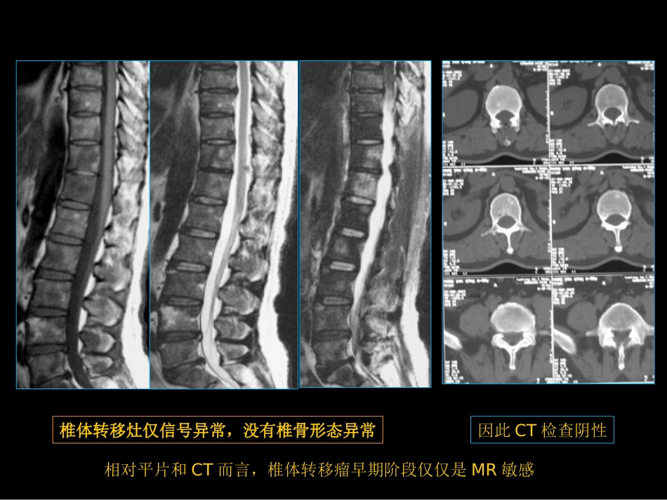 骨与关节常见病影像诊断_第13页