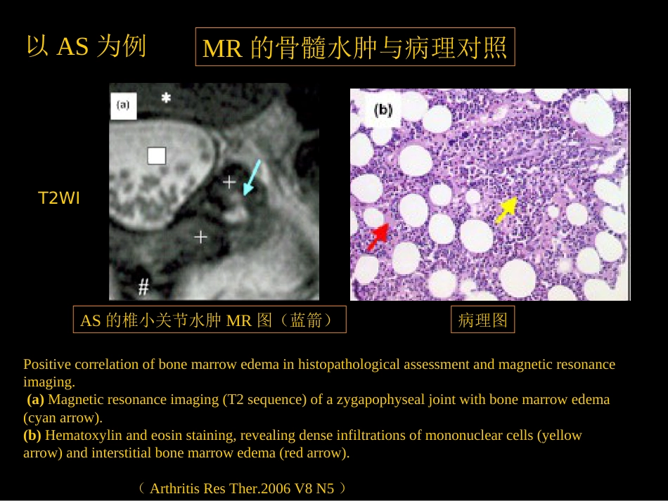 骨与关节常见病影像诊断_第5页