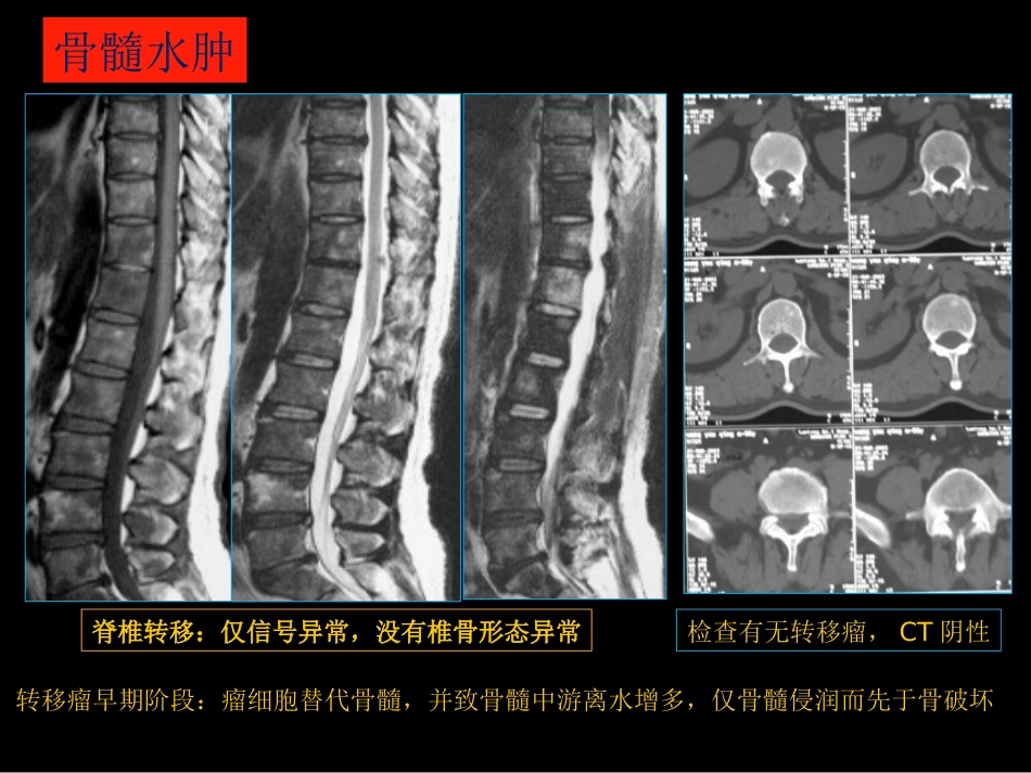骨与关节常见病影像诊断_第7页