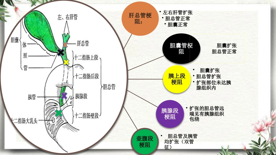 胆道梗阻相关疾病影像学表现_第11页