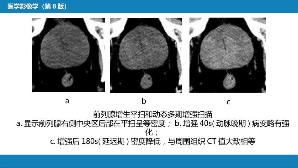 第八章 泌尿生殖系统与腹膜后间隙 第四节 男性生殖系统_第13页