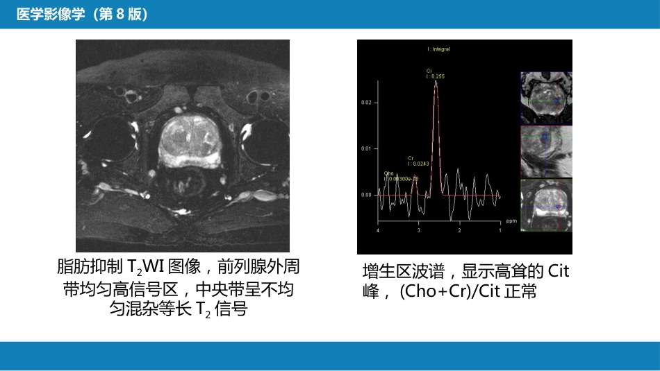 第八章 泌尿生殖系统与腹膜后间隙 第四节 男性生殖系统_第14页