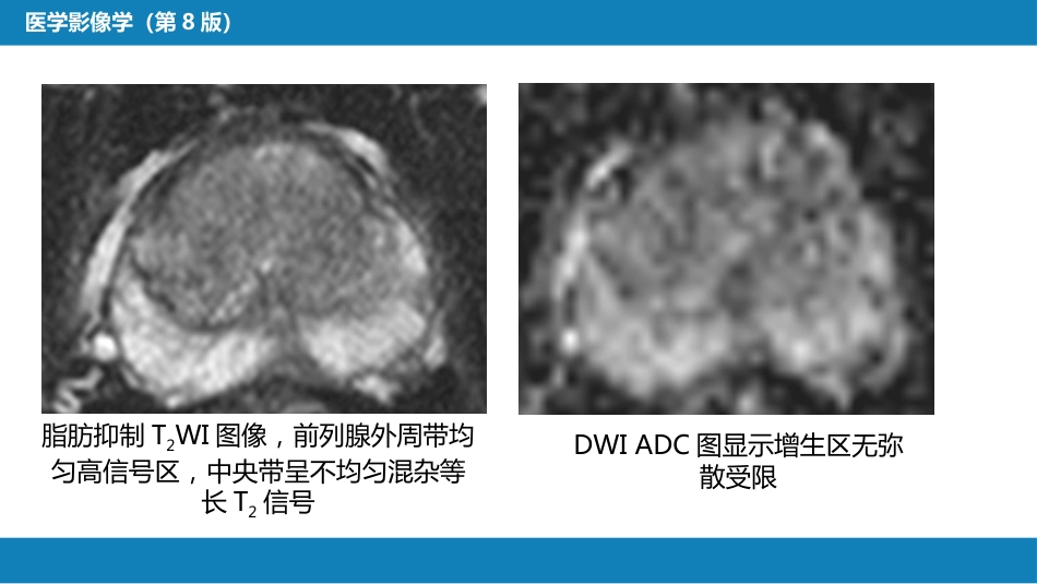 第八章 泌尿生殖系统与腹膜后间隙 第四节 男性生殖系统_第15页