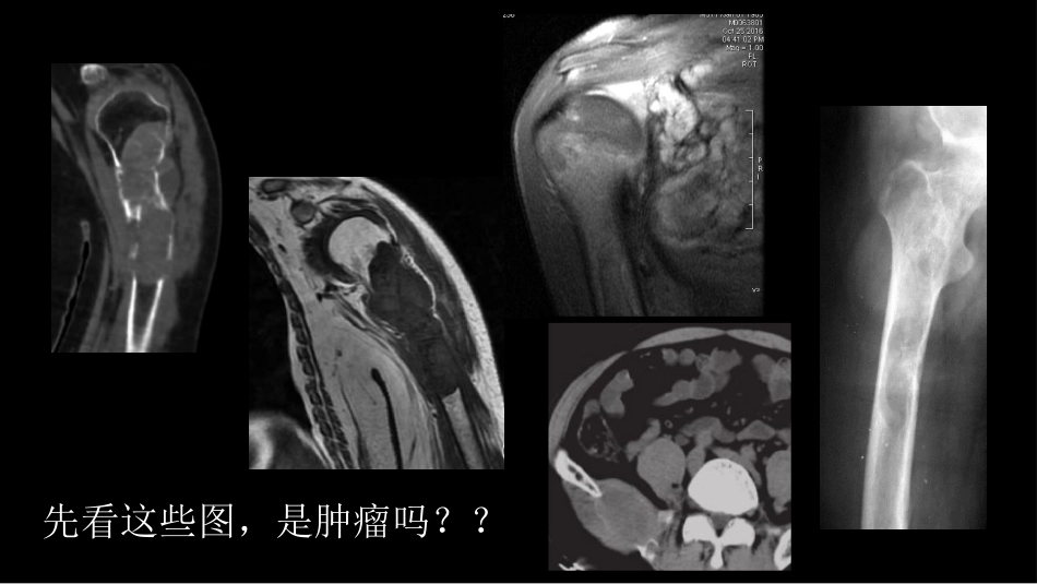 代谢性骨病影像学检查理念暨应用扩展_第3页
