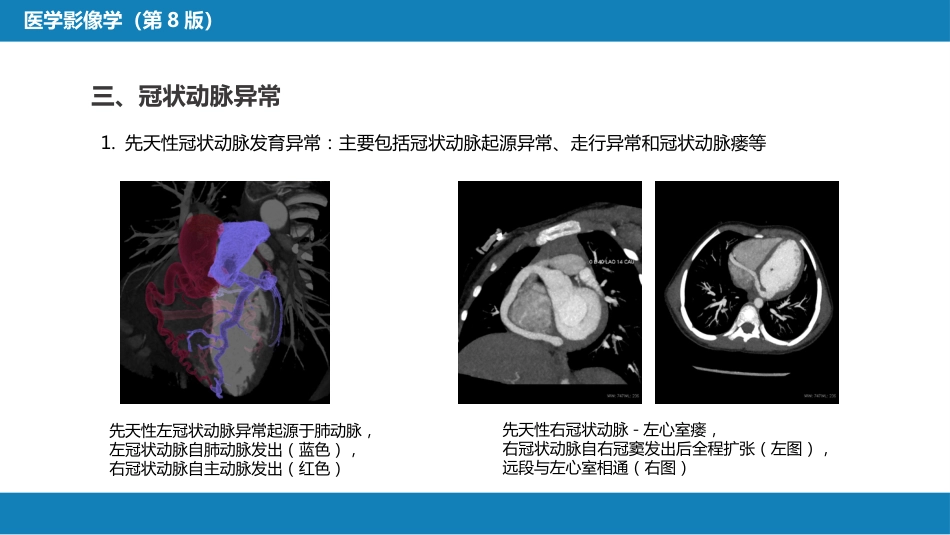 第五章 循环系统 第三节 基本病变表现；第四节 疾病诊断_第12页