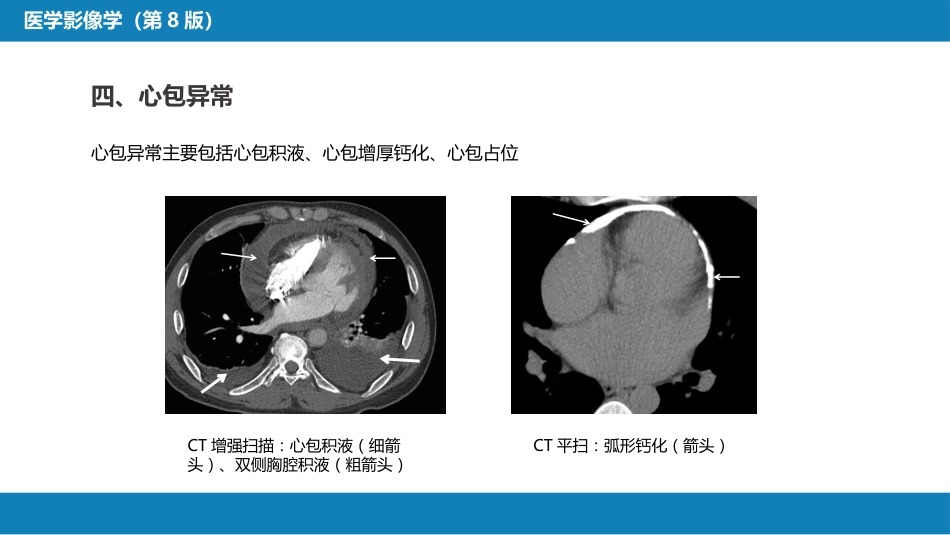 第五章 循环系统 第三节 基本病变表现；第四节 疾病诊断_第14页