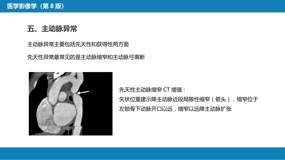第五章 循环系统 第三节 基本病变表现；第四节 疾病诊断_第15页