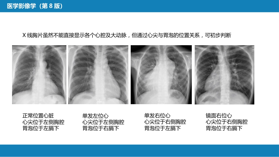 第五章 循环系统 第三节 基本病变表现；第四节 疾病诊断_第7页