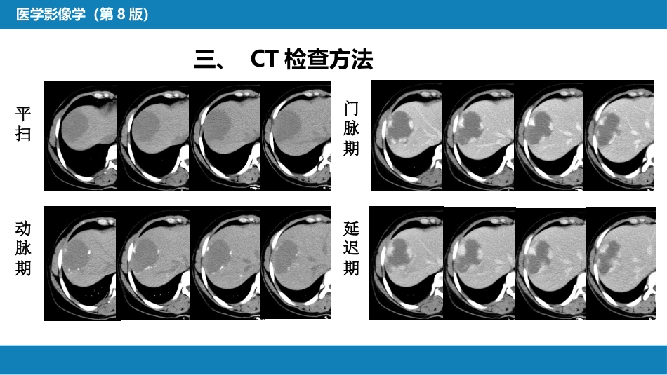 第一章 影像诊断学总论 第二节 X线计算机体层成像_第11页