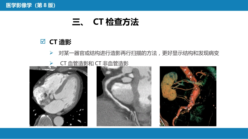 第一章 影像诊断学总论 第二节 X线计算机体层成像_第12页