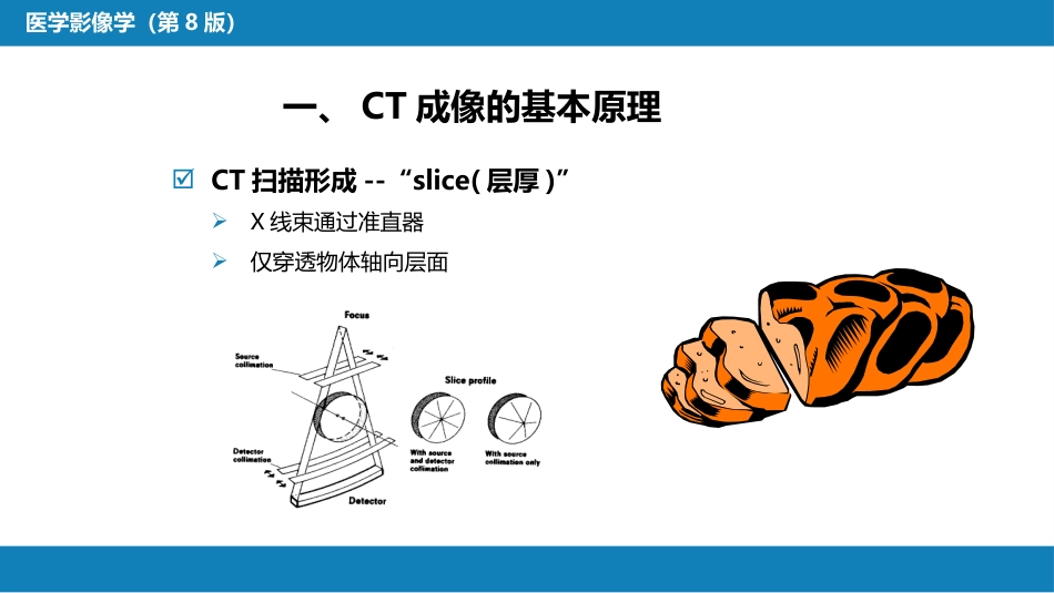 第一章 影像诊断学总论 第二节 X线计算机体层成像_第5页
