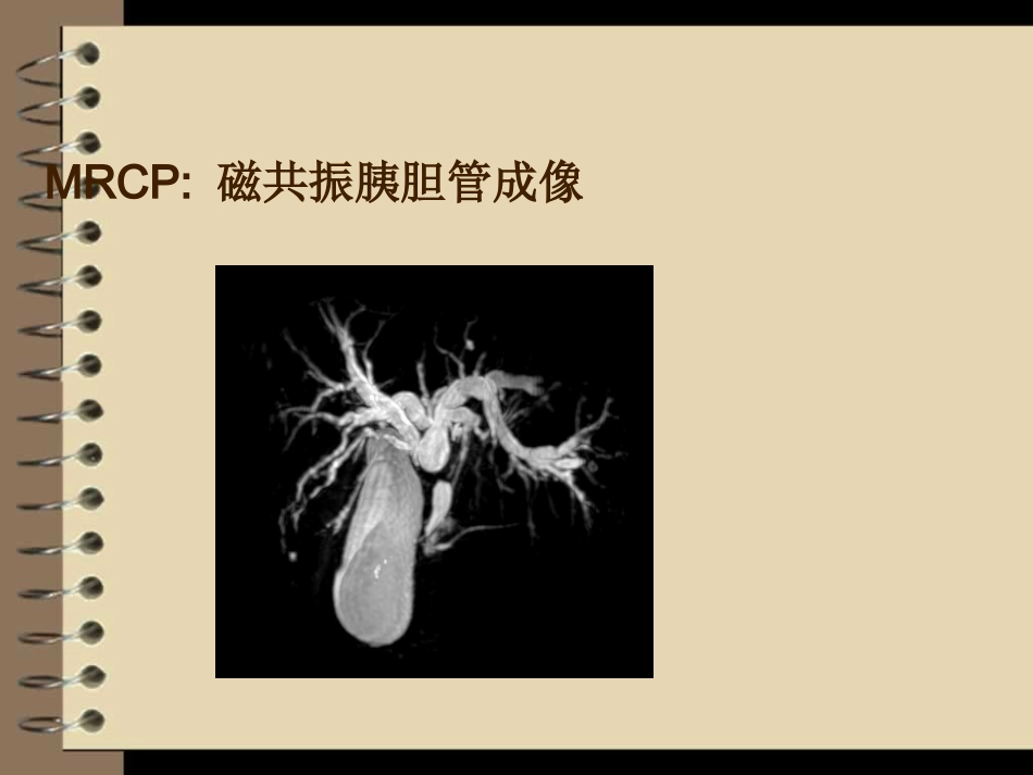 胆道梗阻的影像学诊断_第6页